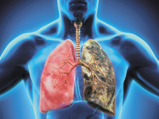 День открытых дверей по вопросам онконастороженности и ранней диагностики рака легких